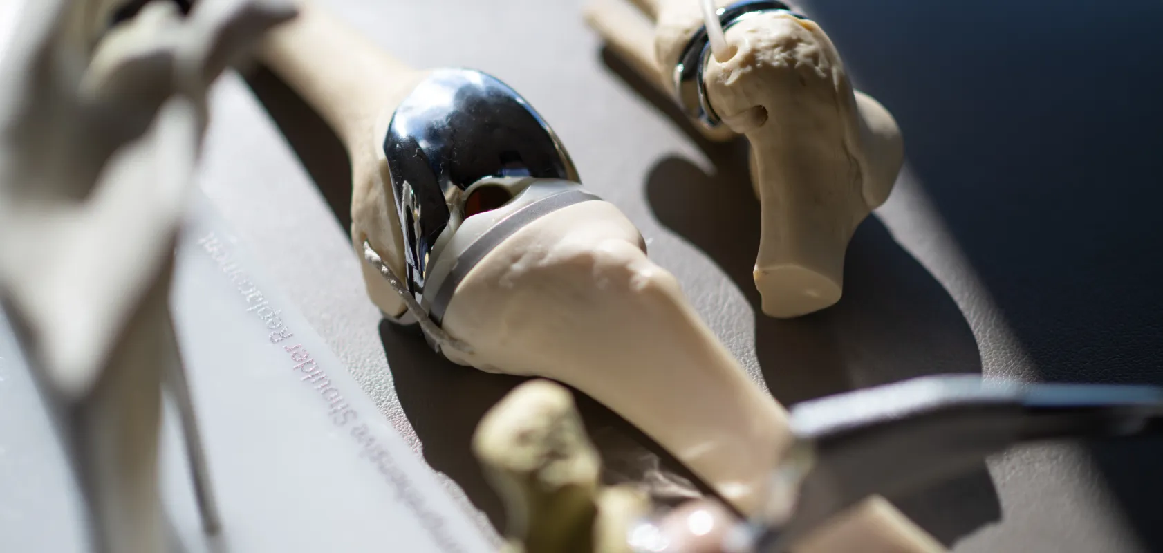 Anatomical knee models showing metal and plastic implants used in total knee replacement surgery.